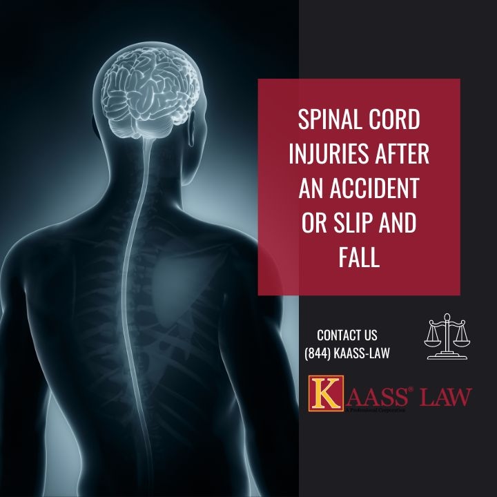 Spinal Cord Injuries After A Slip And Fall Accident
